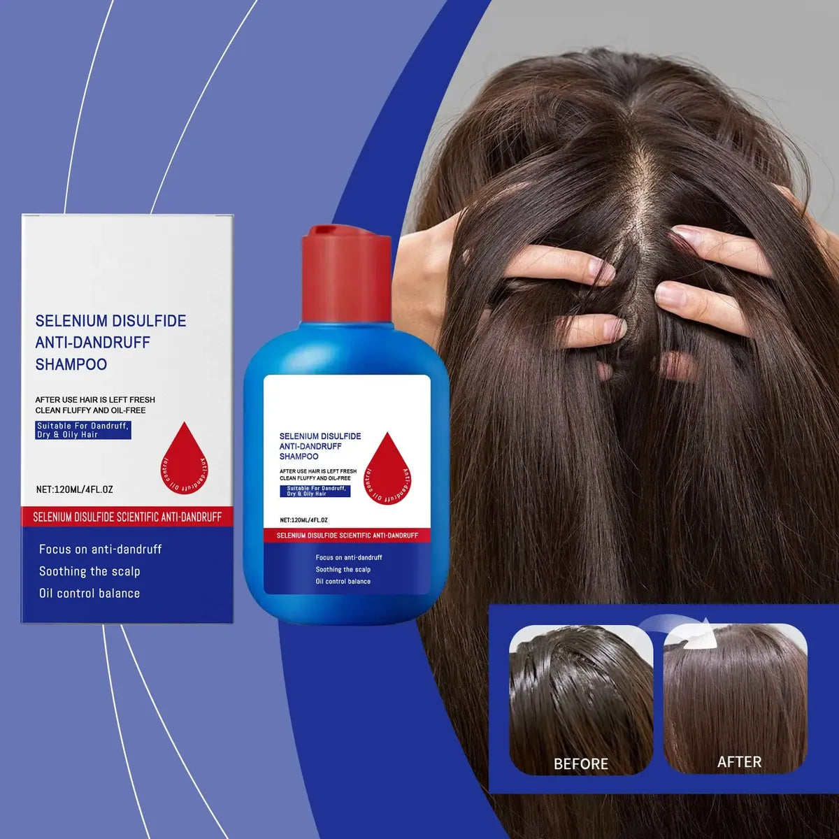 Shampoo NIPPORI 120ml™ | Elimina Caspa, Hongos, Picazón y grasa