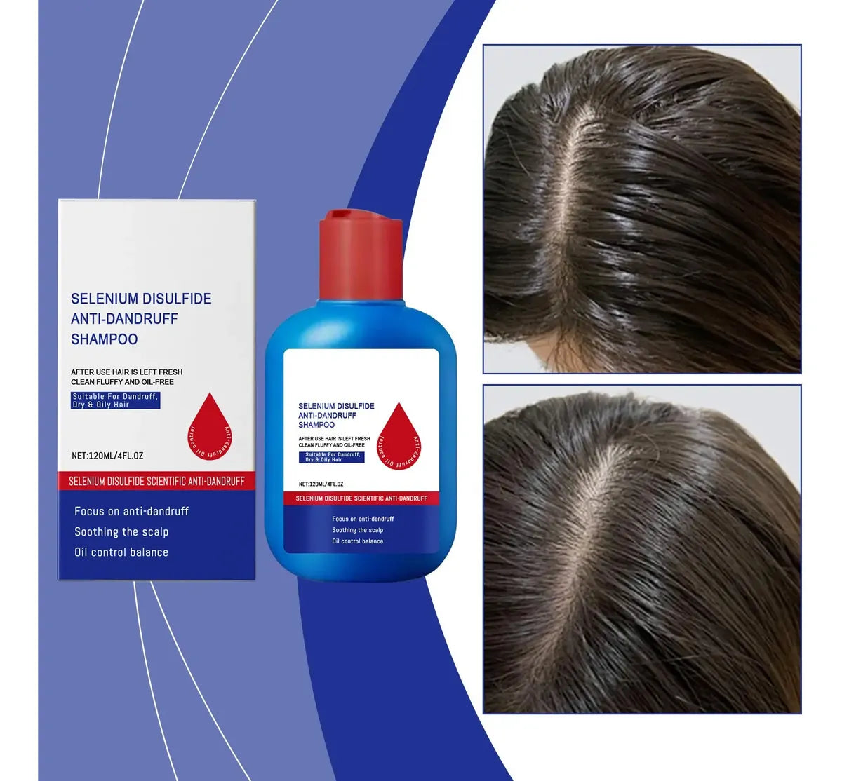 Shampoo NIPPORI 120ml™ | Elimina Caspa, Hongos, Picazón y grasa