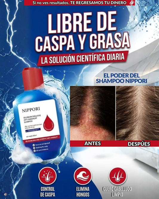NIPPORI Anticaspa 120ml™ | Control de Caspa, Hongos y Picazón